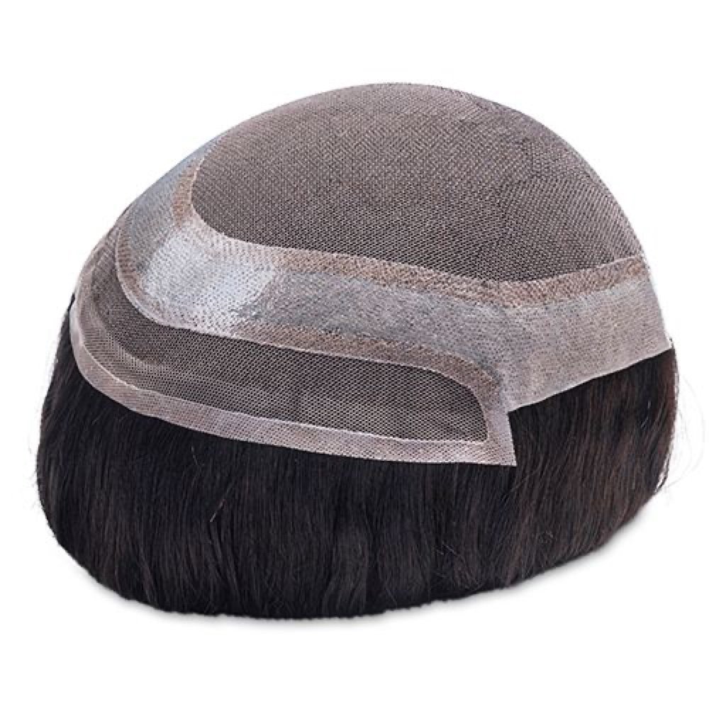 MGM hair patch