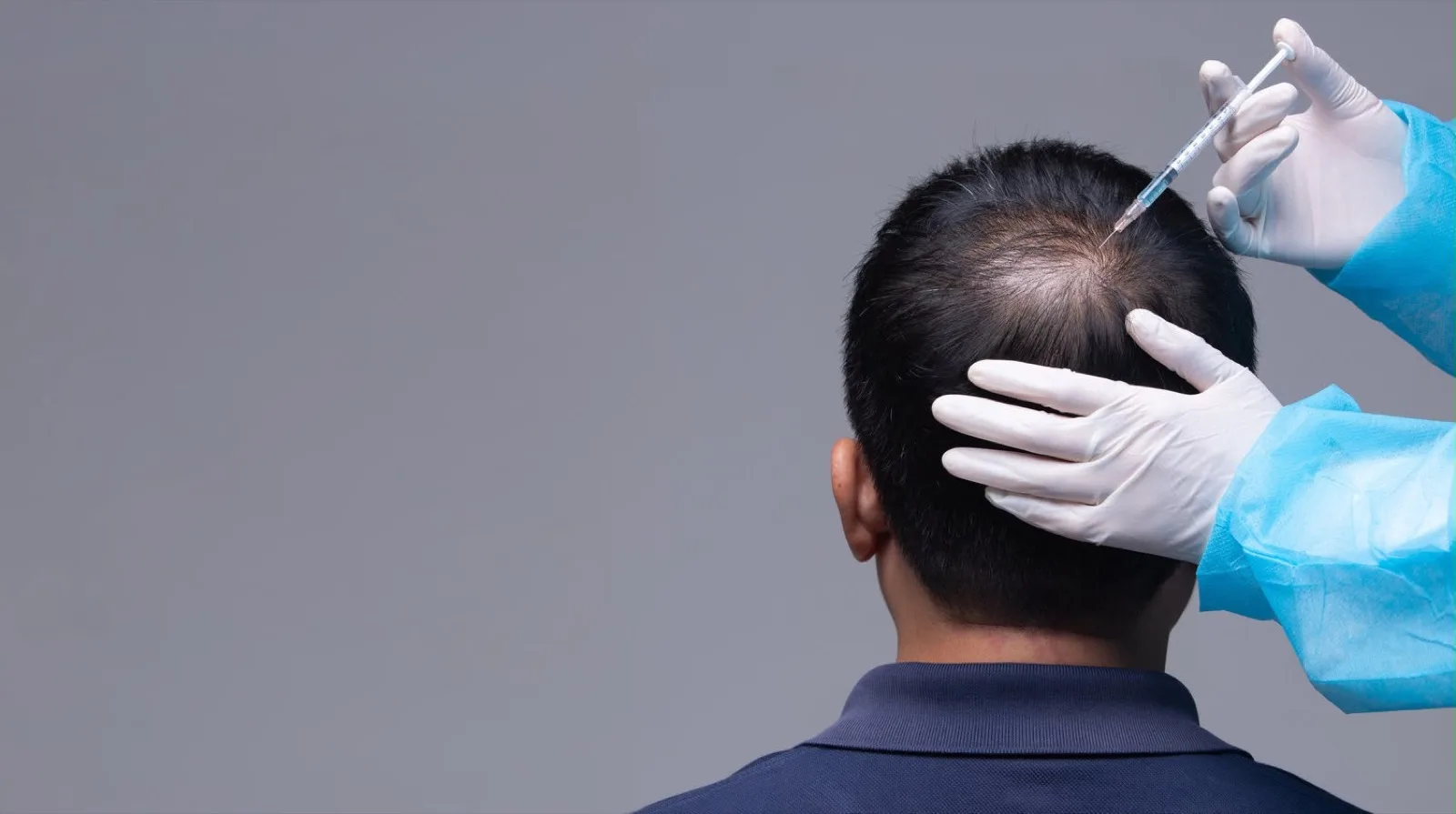 PRP Hair Treatment
